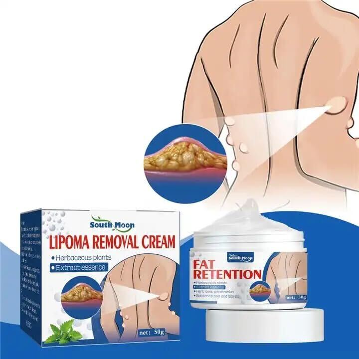 Herbal Lipoma Cream Peeling Fat Mass Remove Miracle Ointment