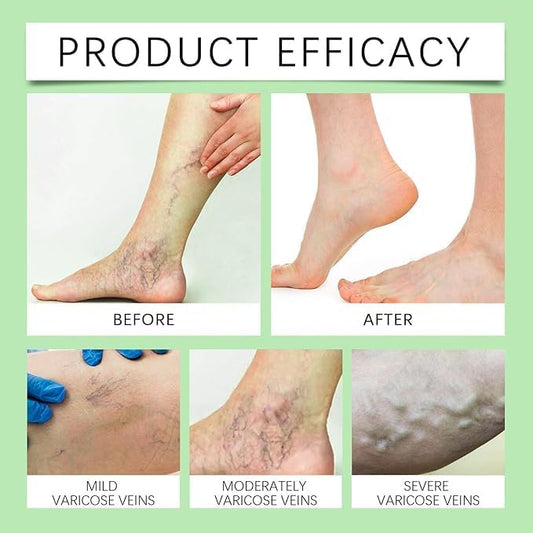 Herbal Miracle Balm for Pain Relief (Pack Of 2)